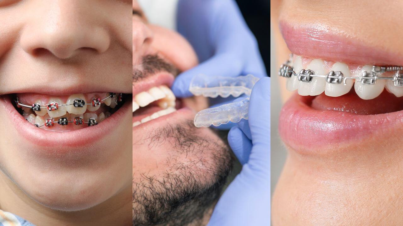 Ortodonzia a Trento 1 dentista trento