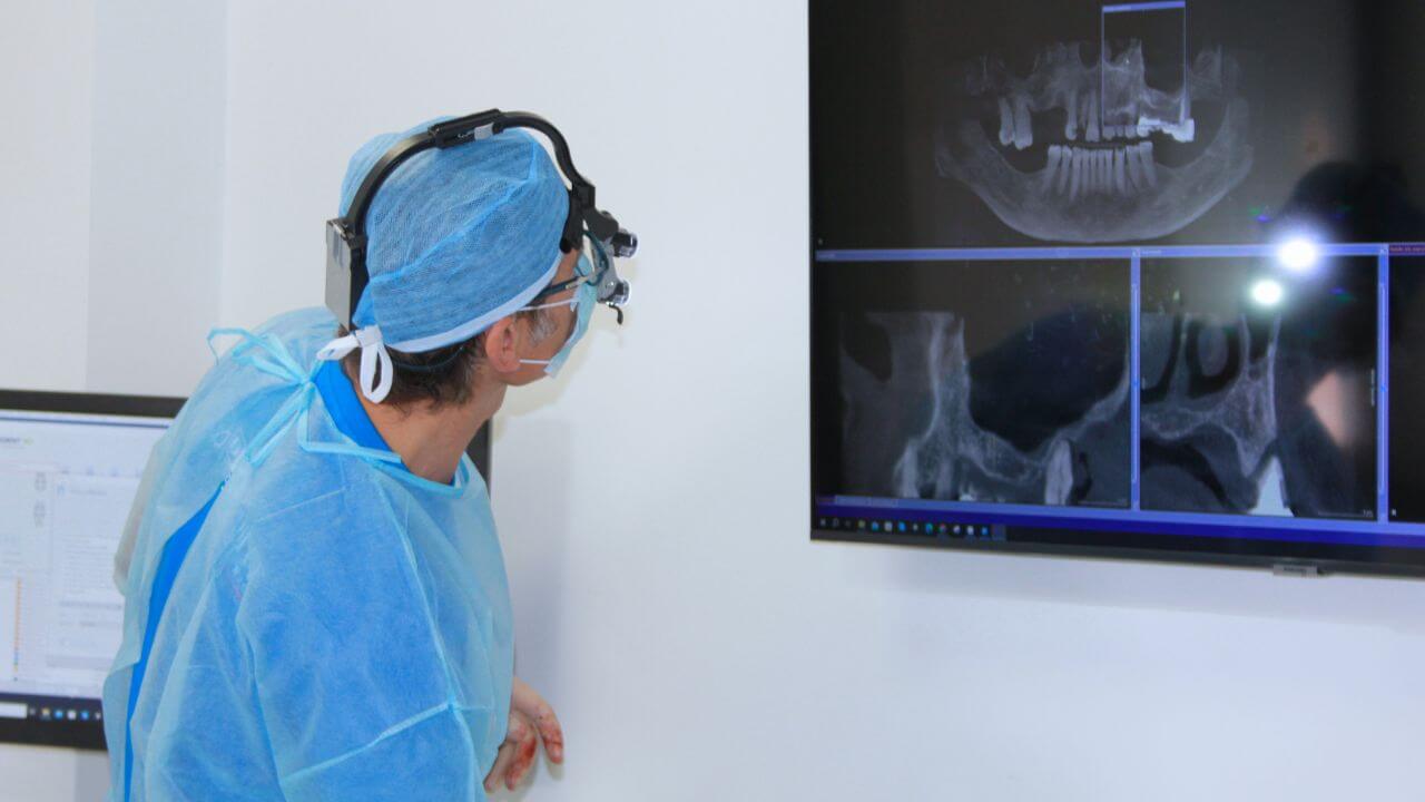 Impianto zigomatico 2 impianti dentali zigomatici trento
