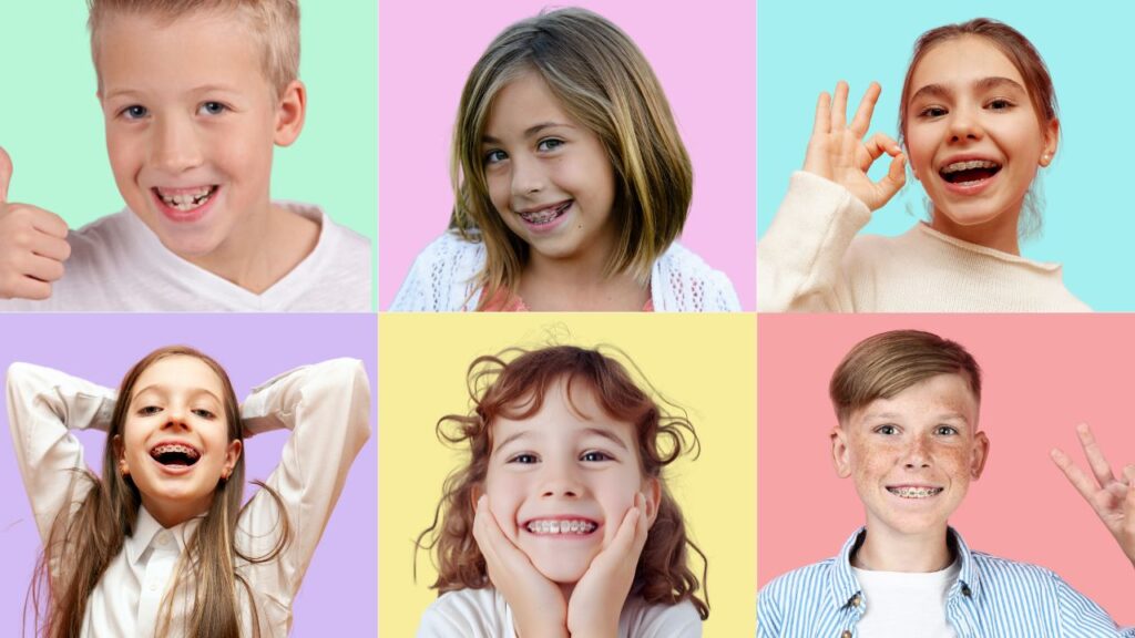 Ortodonzia a Trento 5 apparecchio denti bambini trento dentista