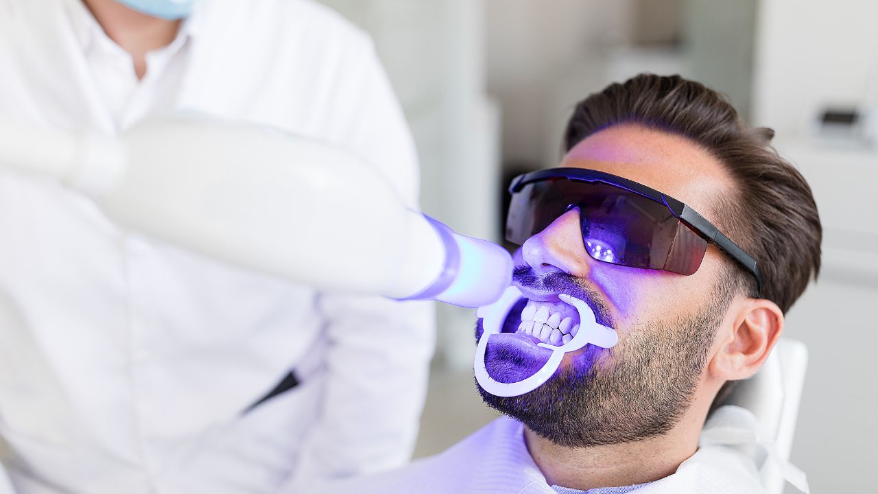 sbiancamento in studio dentista trento