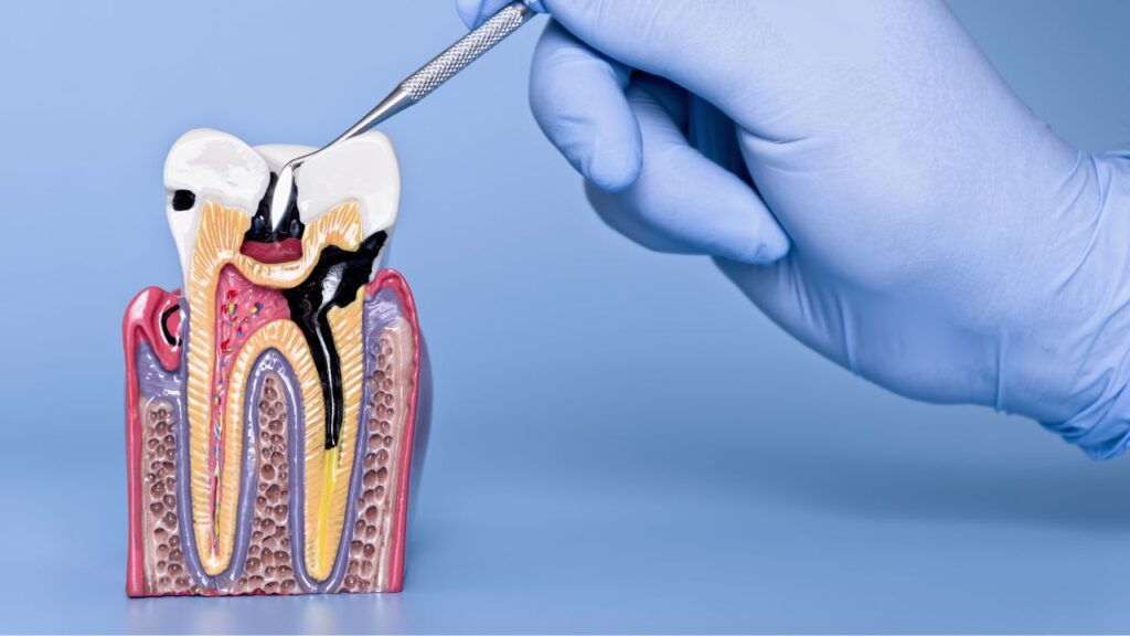 dentista carie trento Dott.ssa Ilaria Baccini