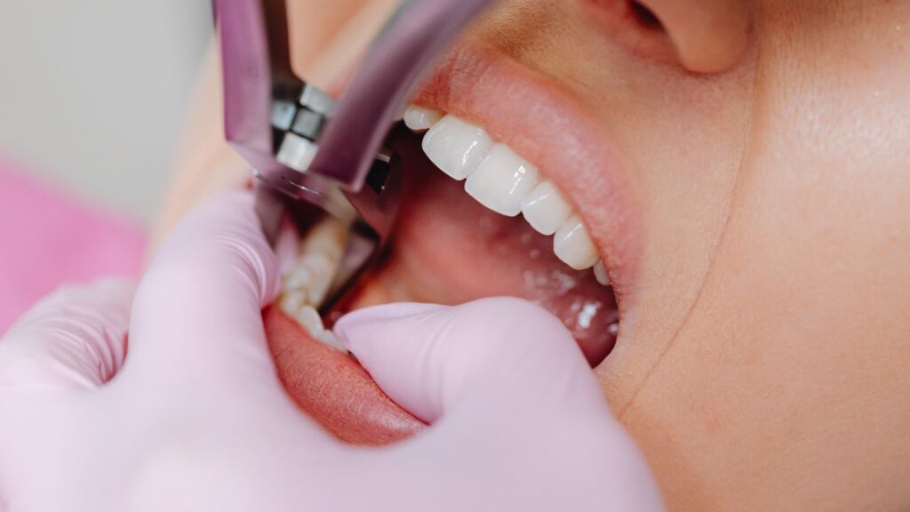 studio dentistico trento carie cura