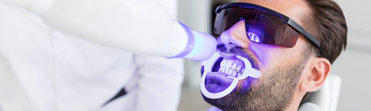 sbiancamento denti trento dentista