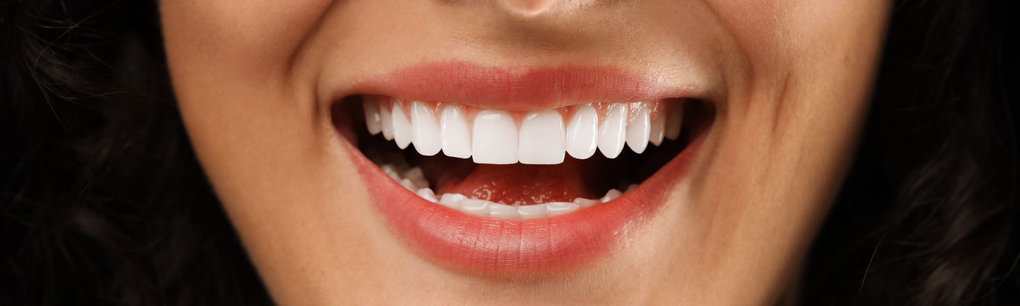 corone in ceramica dentista trento