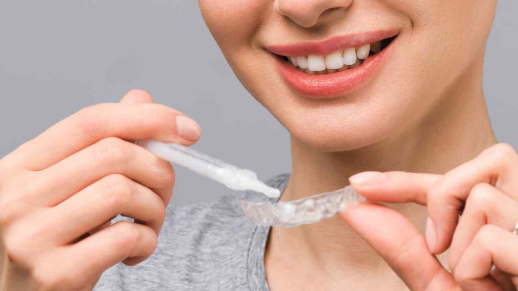 Sbiancamento Denti: Cos’è e Come Funziona 3 kit sbiancamento dentale