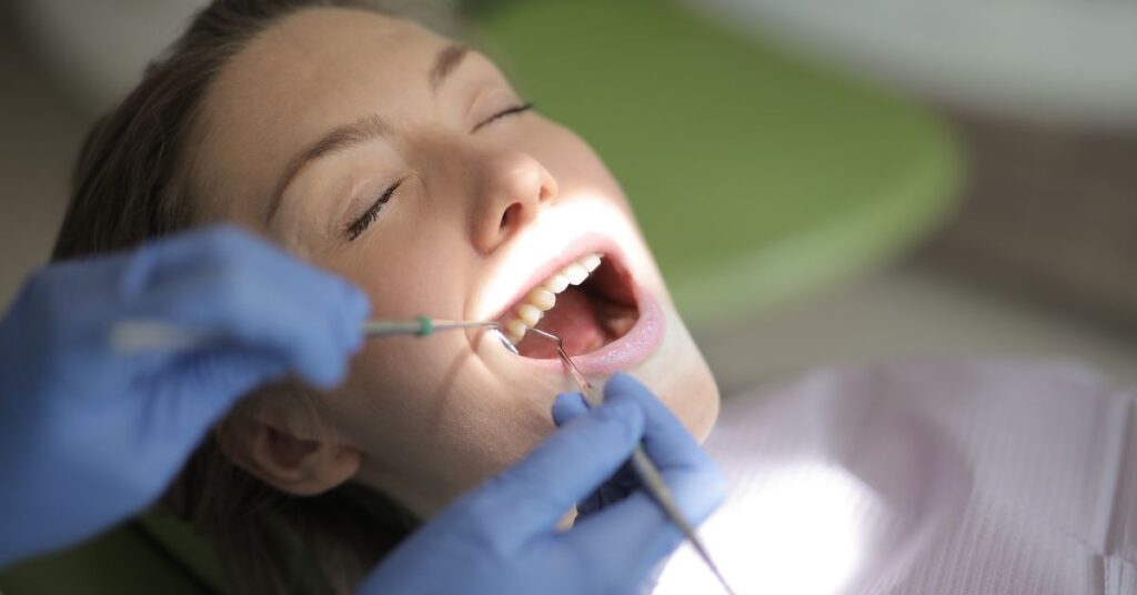 Placca dentale: cause e rimedi 1 placca dentale