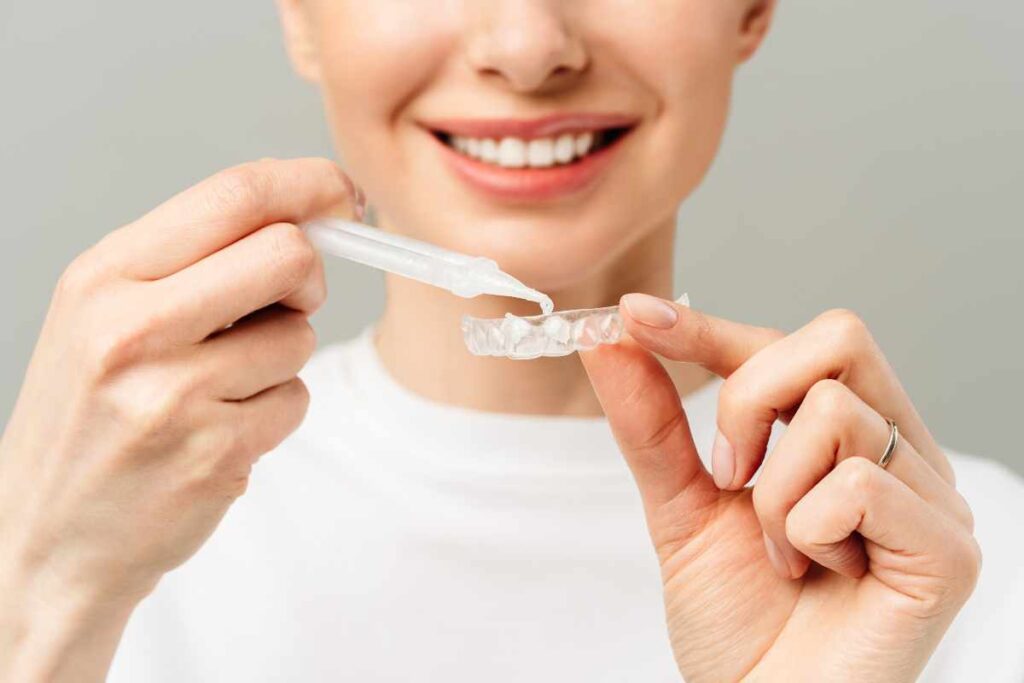 Dentisti a Trento: Affidati all'esperienza del Dr. A. Costa 5 sbiancamento dentale kit da casa white