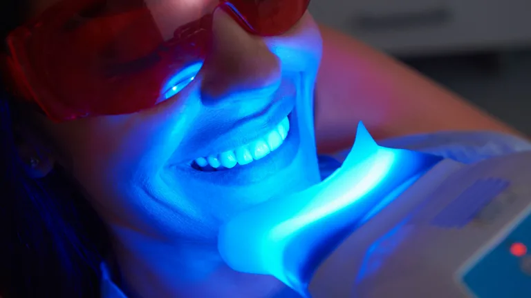 sbiancamento denti professionale