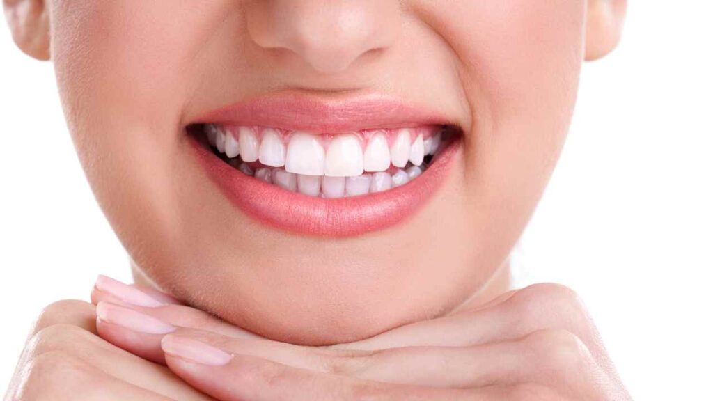 Guida Completa 2024 sulla Scelta del tuo Dentista a Trento 4 sbiancamento denti trento